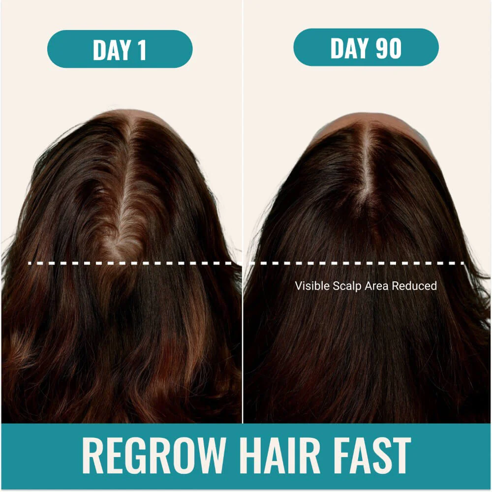 Clinical Hair Growth+ - Image 5